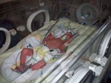 Lara 2 days old in Gloucester SCBU