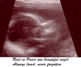 Our little Peanut