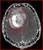 Fundraiser icon