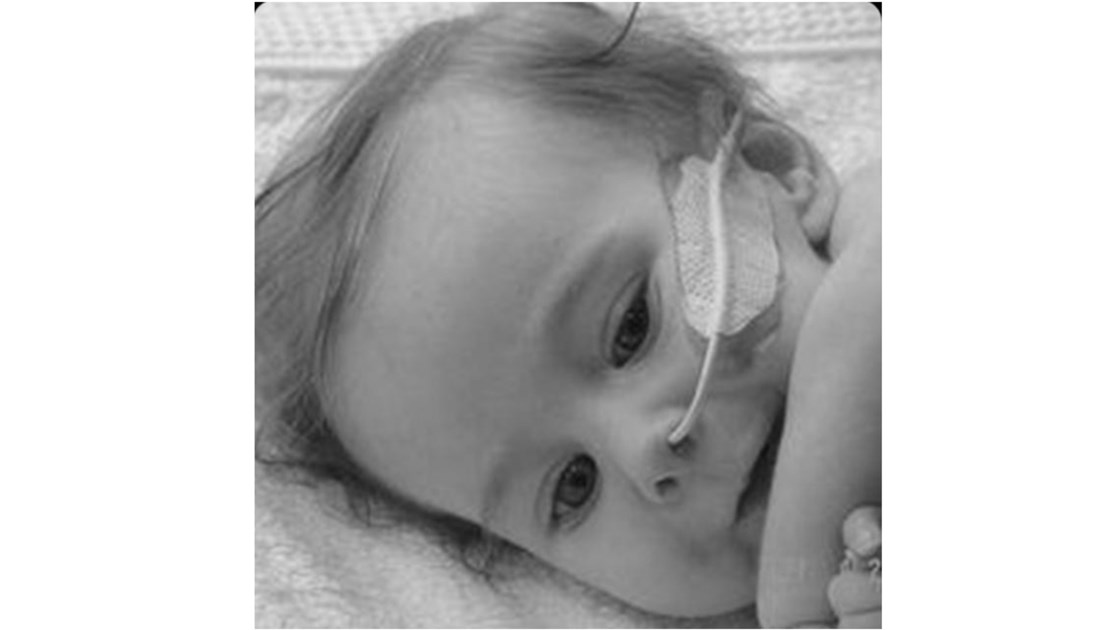 Jason Turk Jason Turk is fundraising for Spinal Muscular Atrophy (SMA) UK