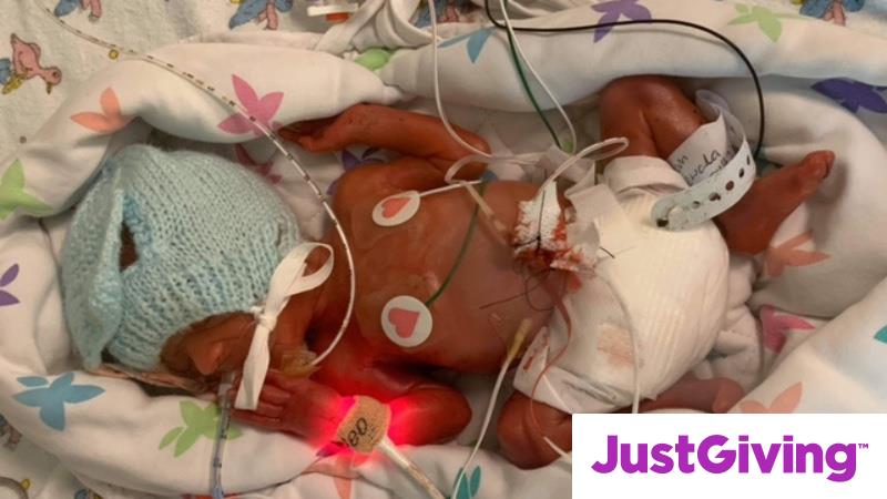 Crowdfunding To Support The Life-saving Work Of The NICU (Neonatal Intensive Care Units) At ...