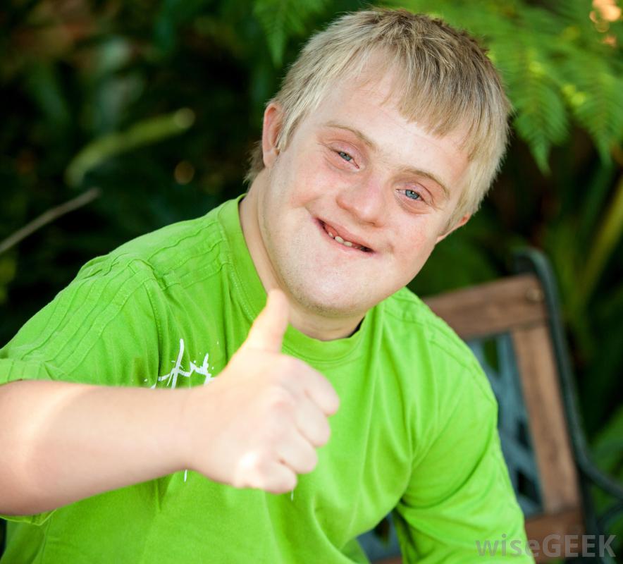 Crowdfunding To Help Dave Who Has A Rare Type Of Down Syndrome Which Is 