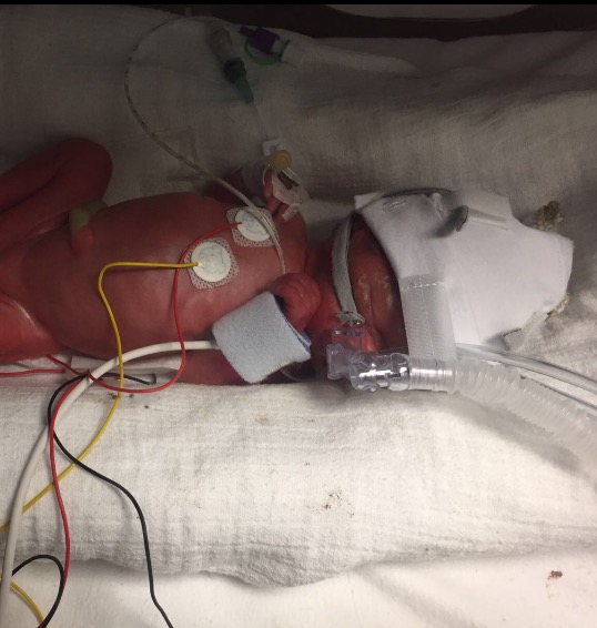 Crowdfunding to Support Sunderland Royal Hospitals Neonatal ICU to help ...