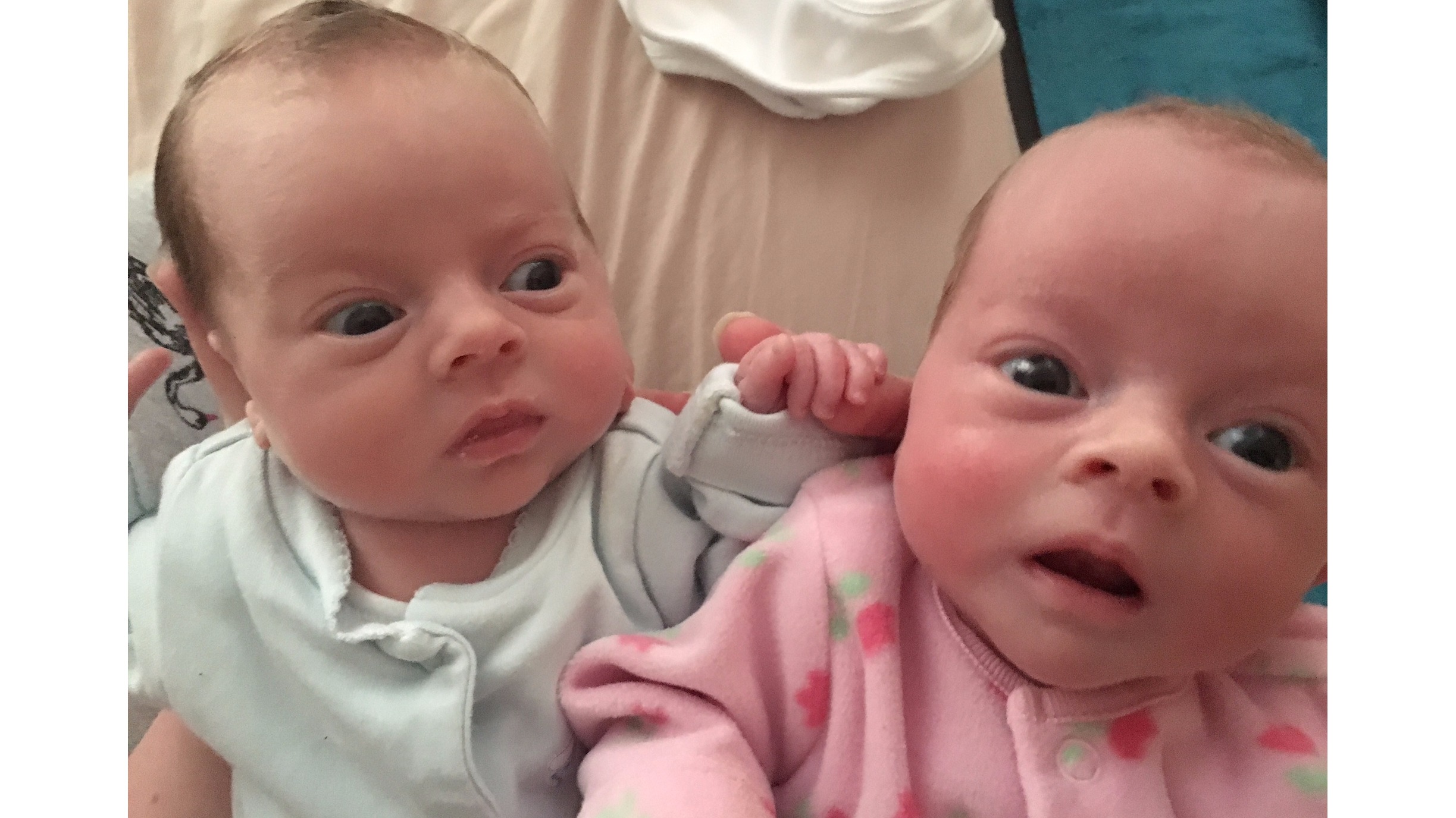 What Is Twin Twin Transfusion Syndrome How Is It Trea vrogue.co